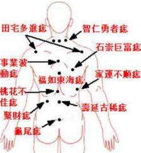 屁股痣位置|屁股上有痣代表什麼命運？